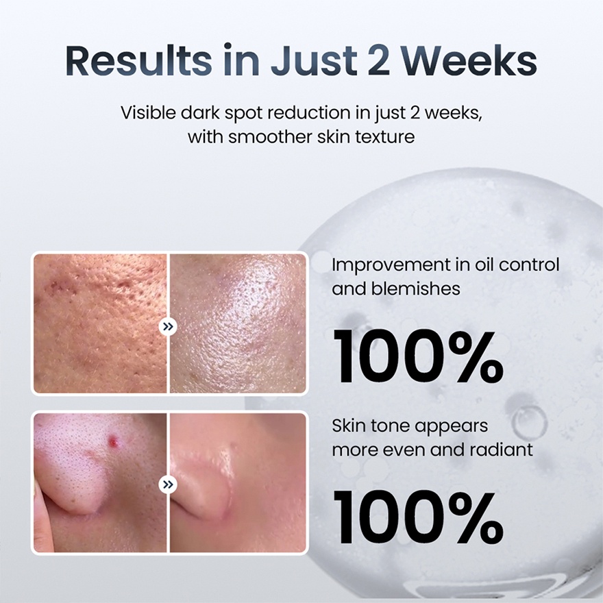 Niacinamide 15% Zinc Beads Serum 30ml