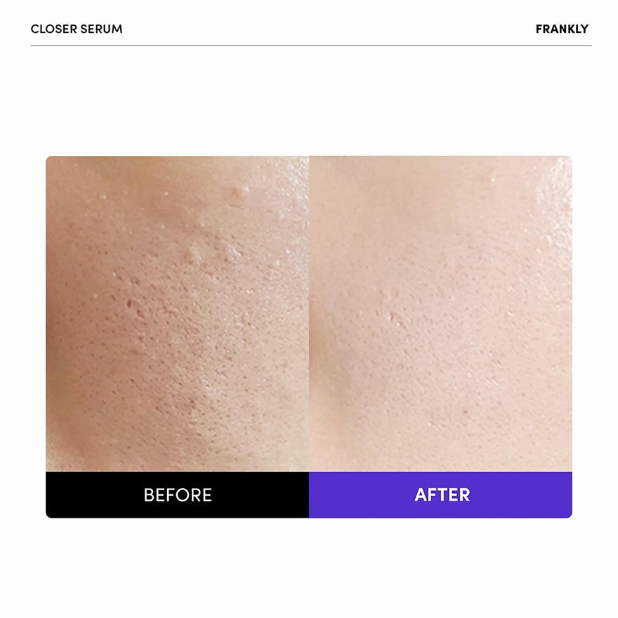 Closer Serum 30ml