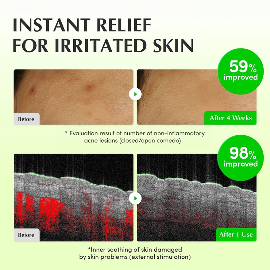 Green Aid Aloe PDRN Calming Toner 150ml image