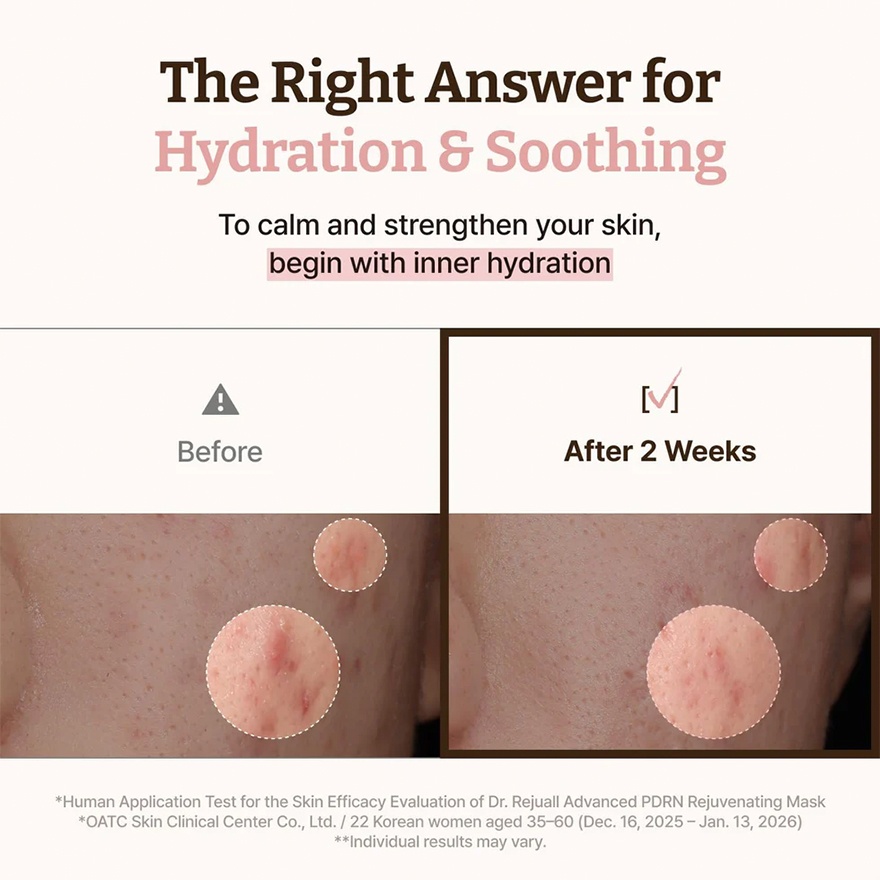 Advanced PDRN Rejuvenating Mask 1S image