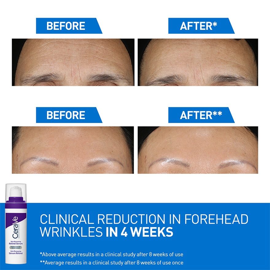 Skin Renewing Retinol Serum 30ML