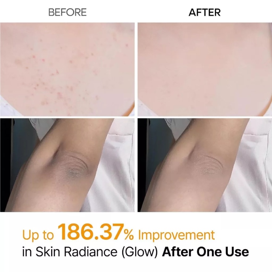 Peel Shot Exfoliating Kojic Acid Turmeric Spray 200ml