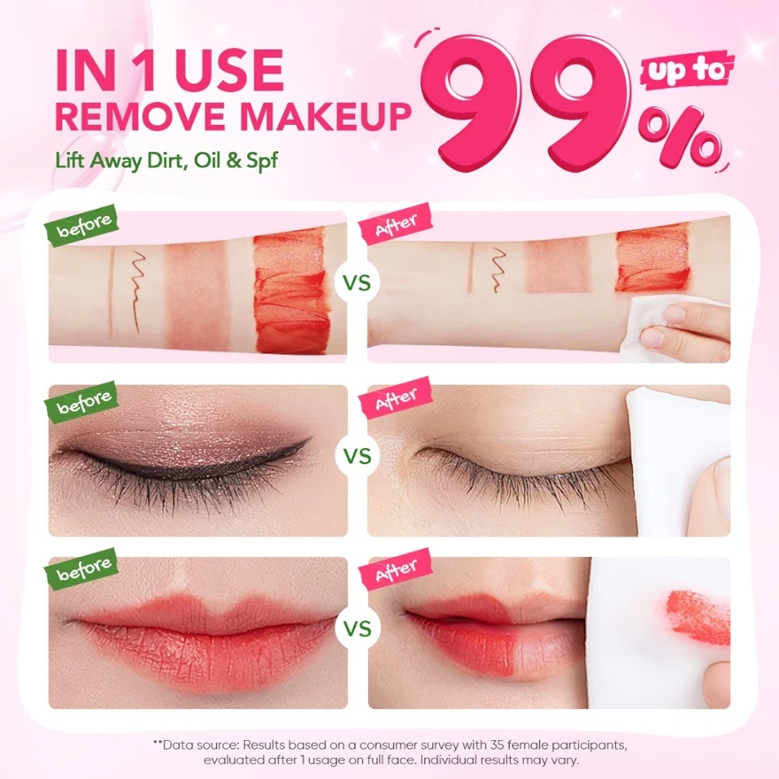 Micellar Cleansing Wipes 10S image