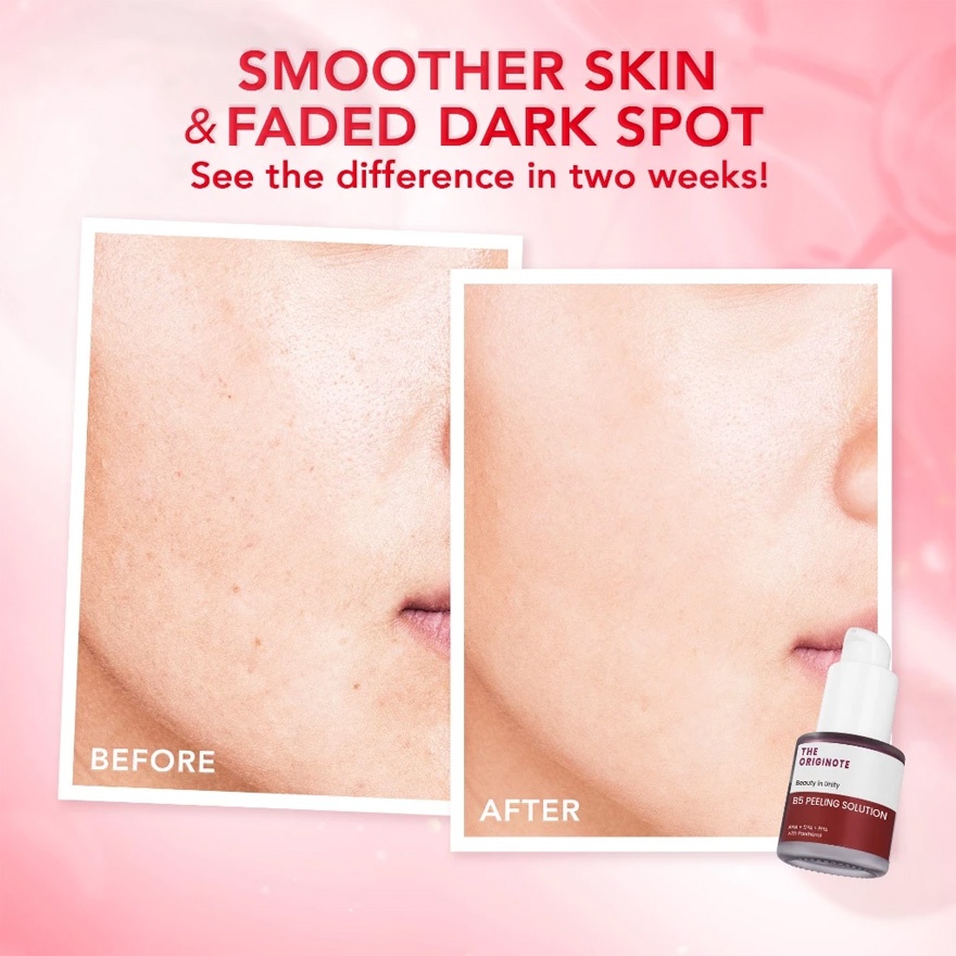 B5 Peeling Solution Serum 20ml image