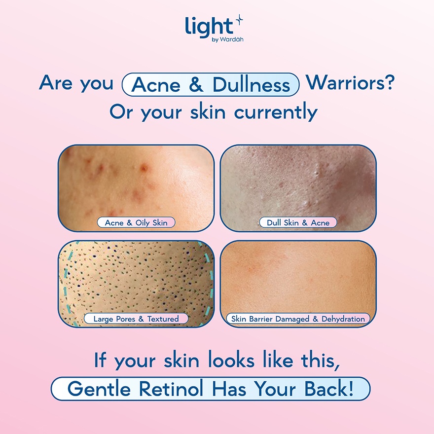 HPR Retinoid Bright + Acne Serum Moisturizer 28 g image