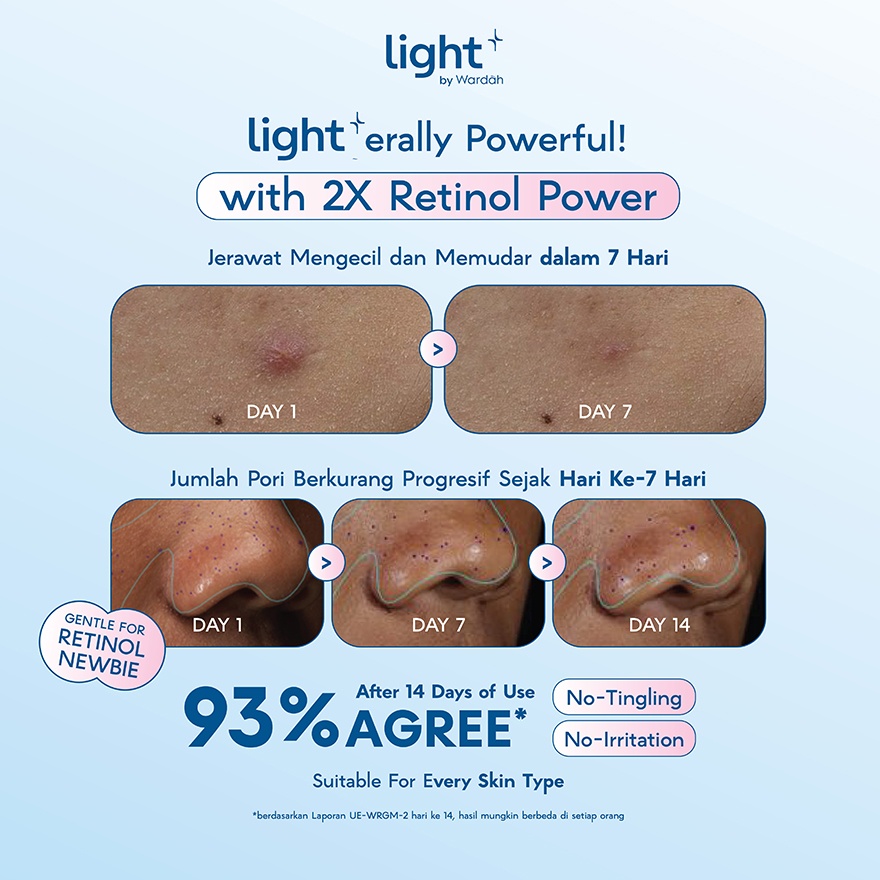 HPR Retinoid Bright + Acne Serum Moisturizer 28 g image