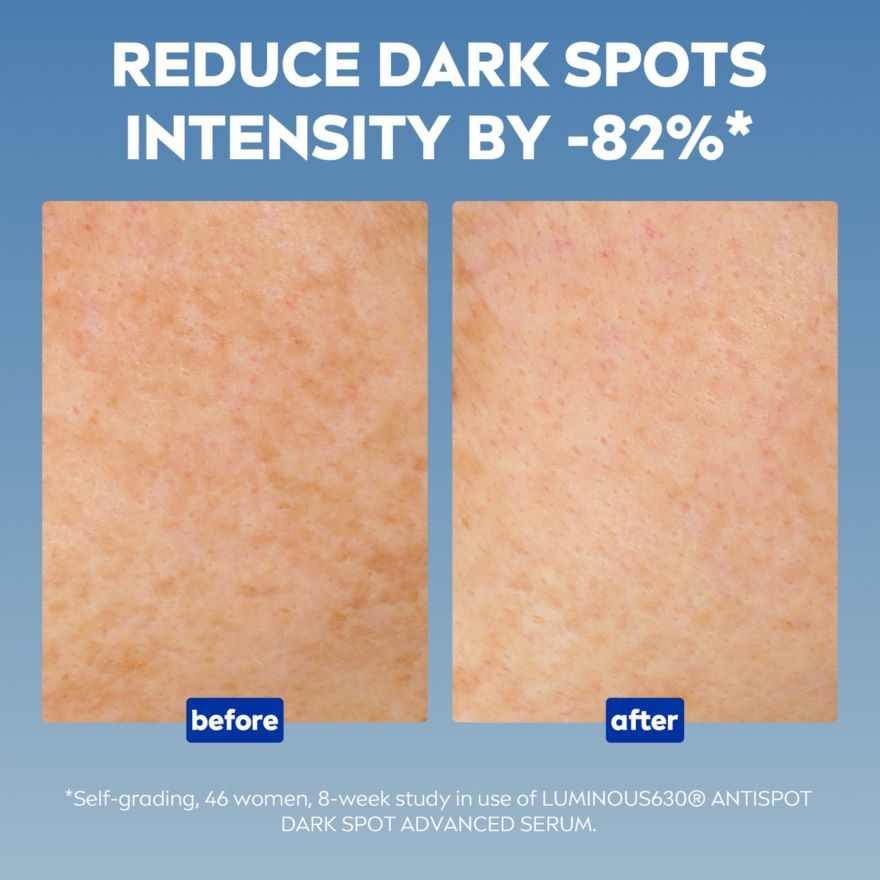 Luminous630 AntiSpot Anti-Age & Spot Serum 2x30ml