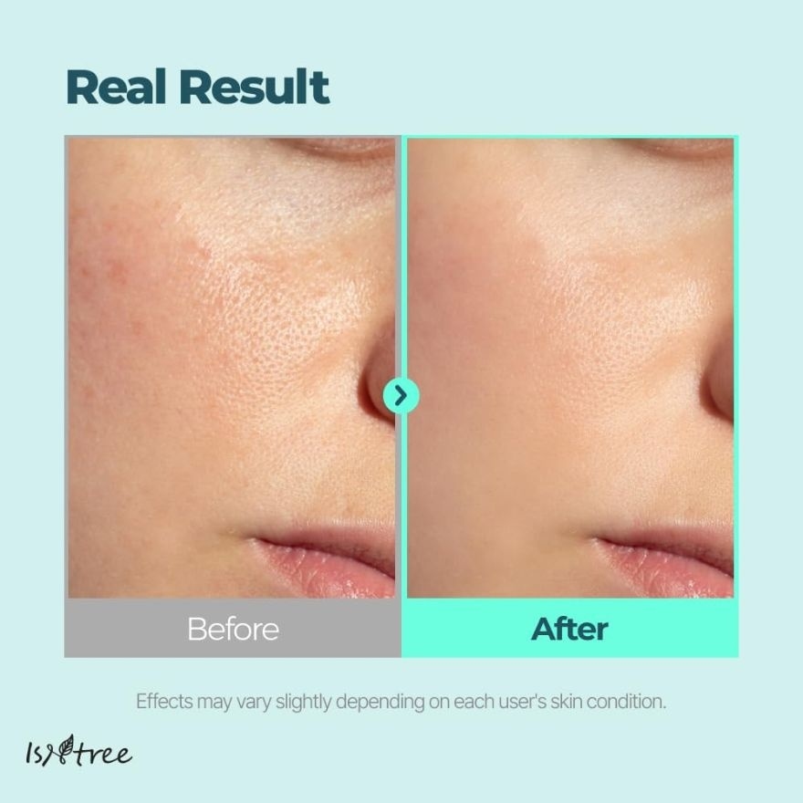 Gim PDRN Hydro Bouncy Ampoule 50ml image