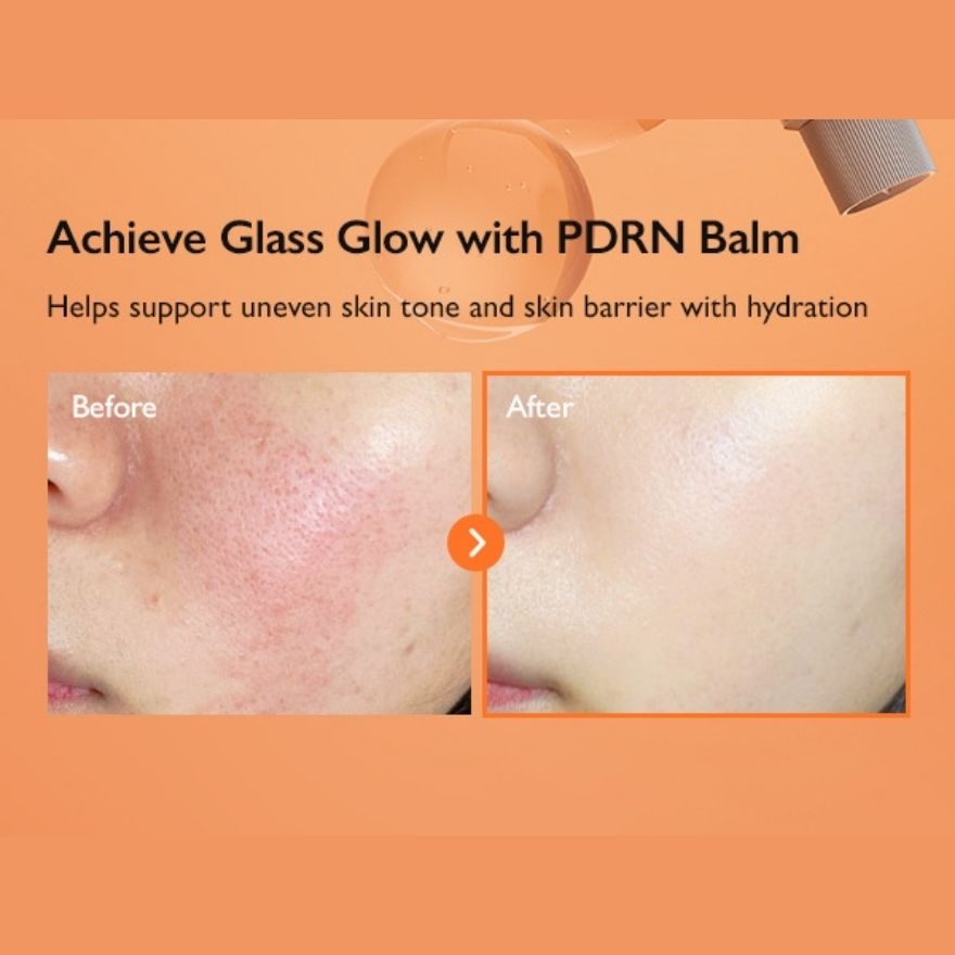 PDRN Enriched Recovery Balm 50ml image