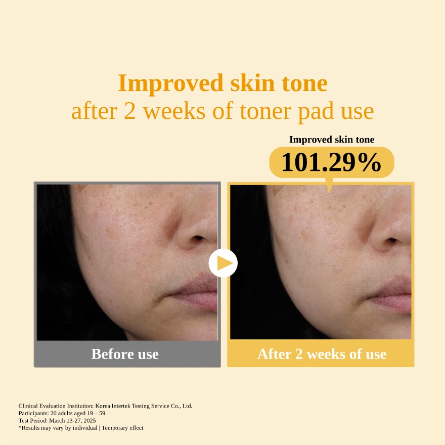 Vita Duo Whitening Toner Pads 1s image