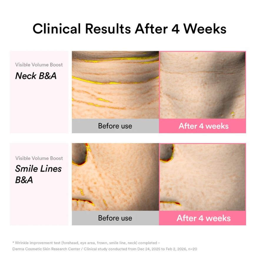 PDRN Volume fill it Booster crème 2.5 tube 30ml image