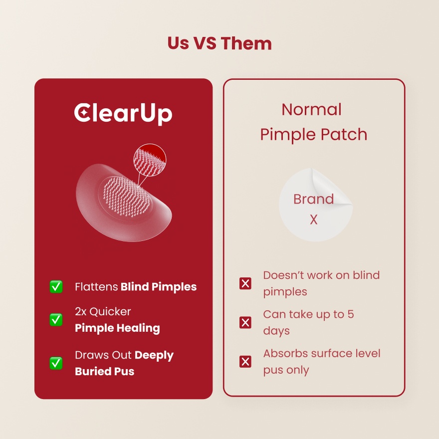 Microdarts for Acne 9s image