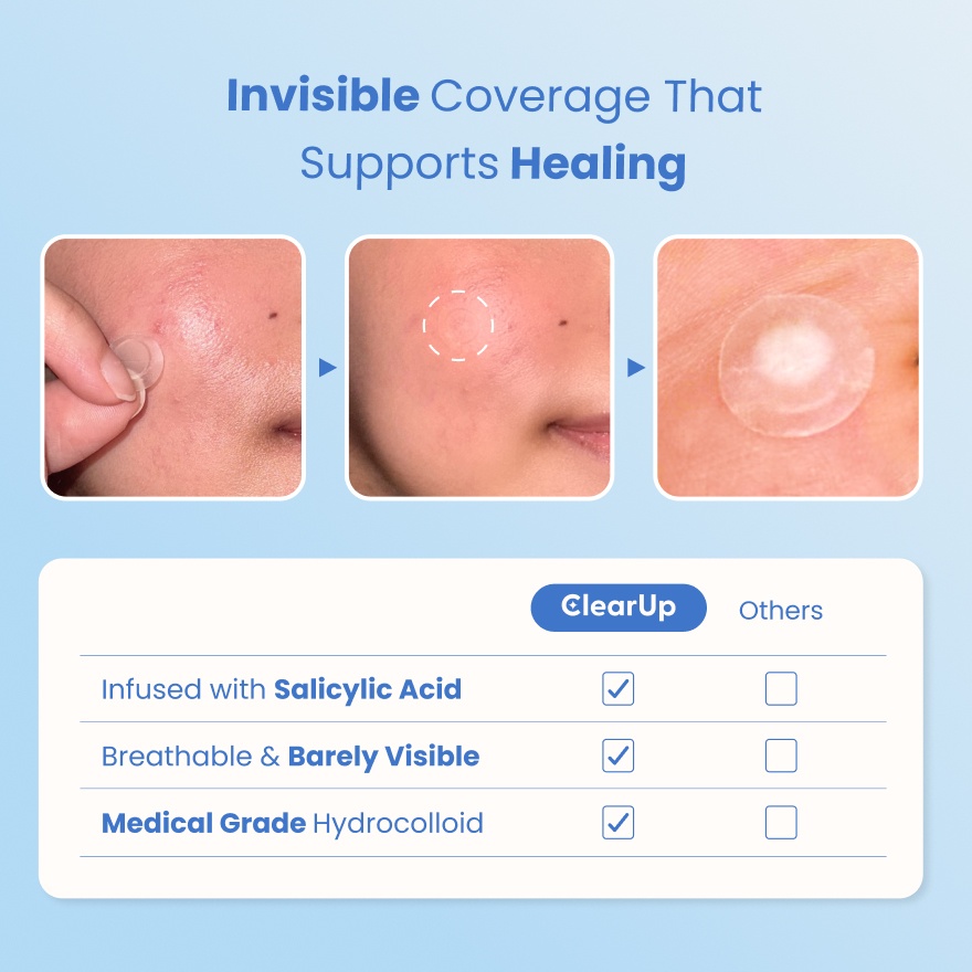 Invisipatch for Acne 18s image