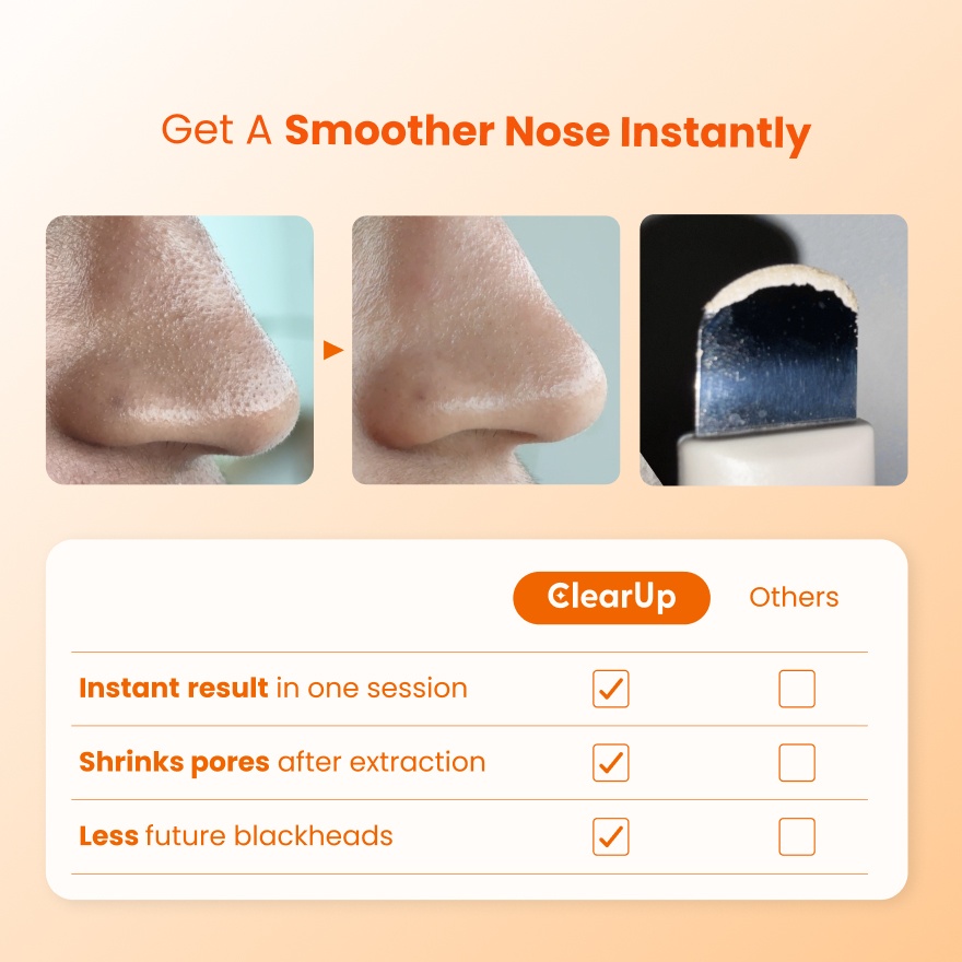 Blackhead Buster Kit 4s image