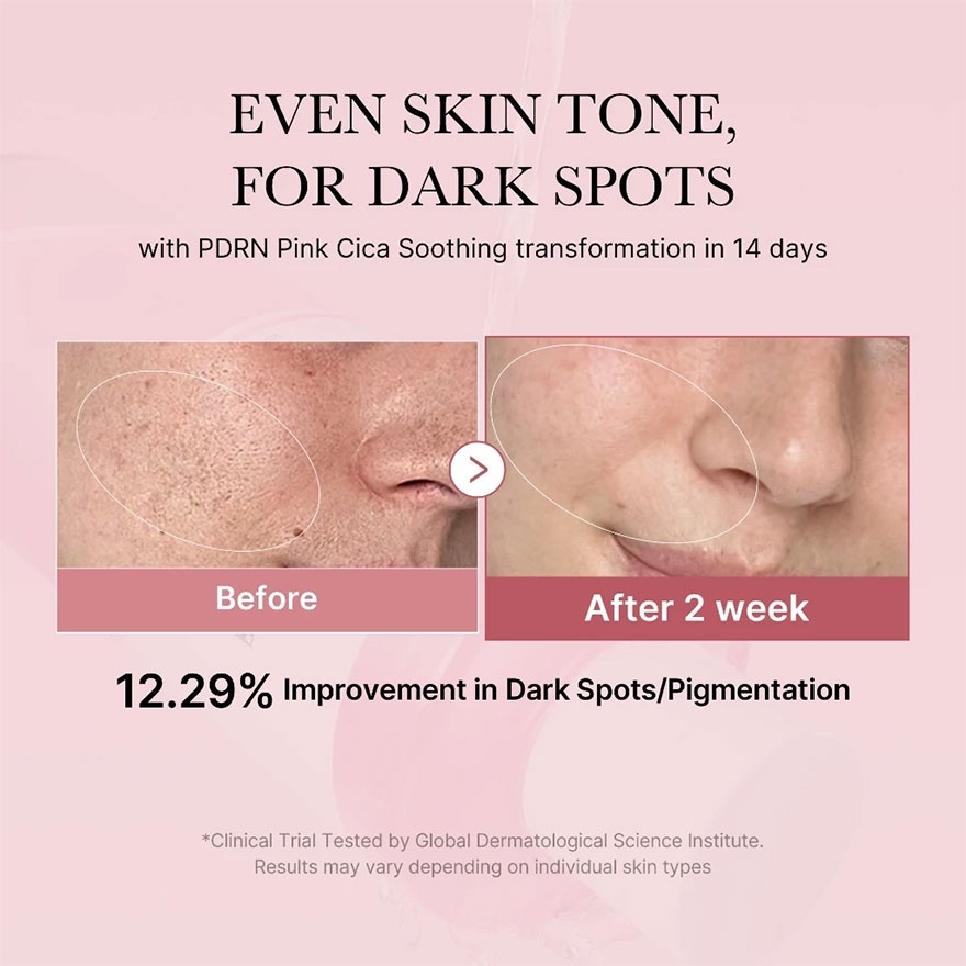 PDRN Pink Cica Soothing Toner 30ml image