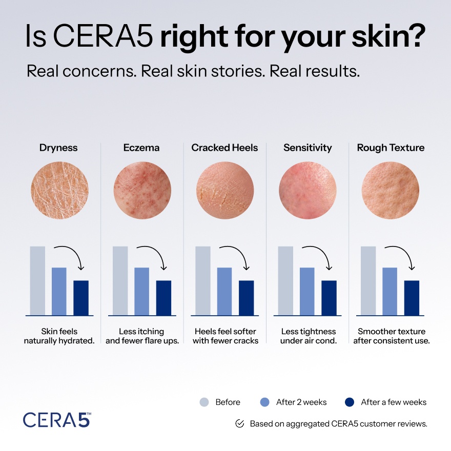 Cera5 60s image