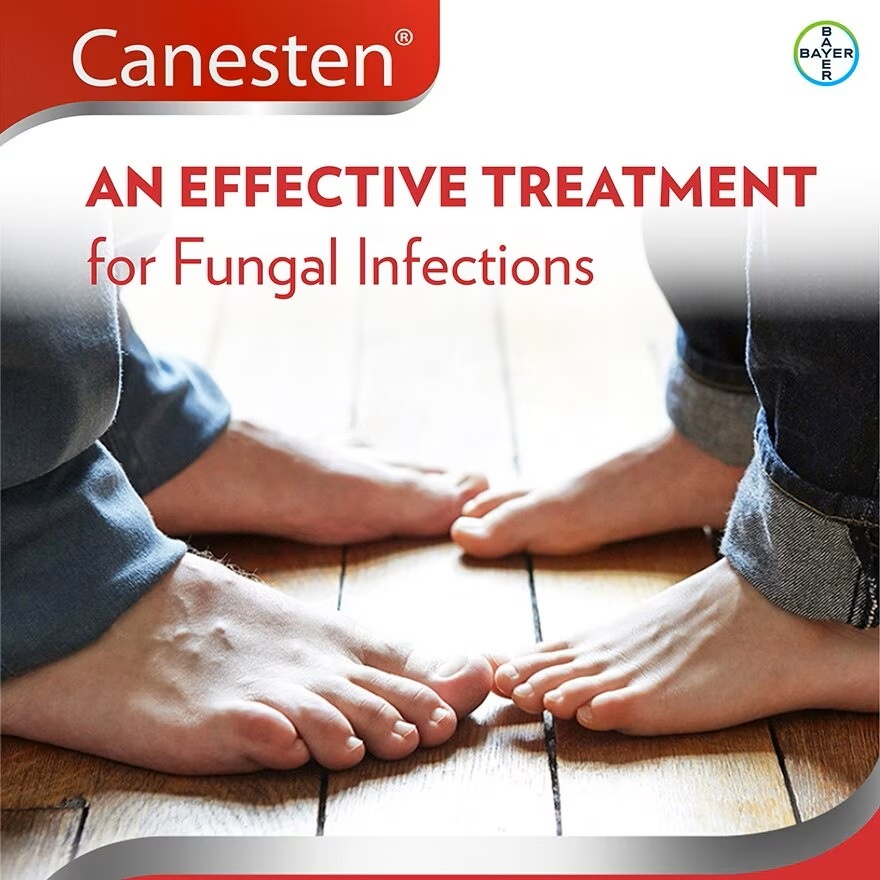 Clotrimazole Cream 1% For Antifungal 10g image