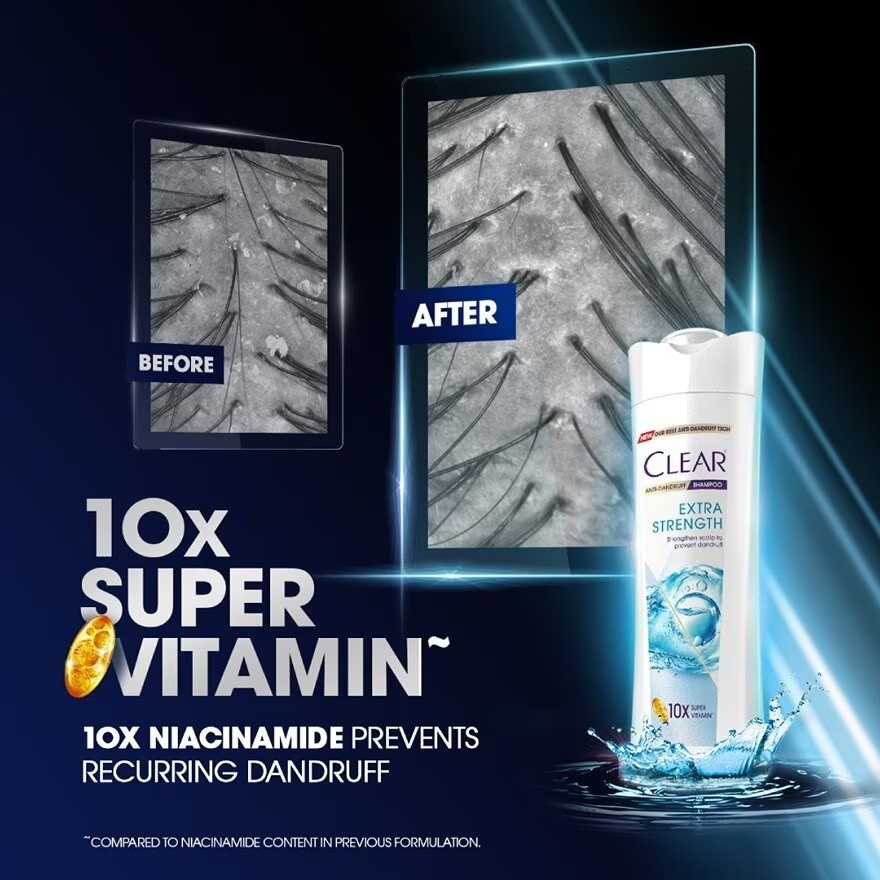 Anti-Dandruff Extra Strength Shampoo 300ml image