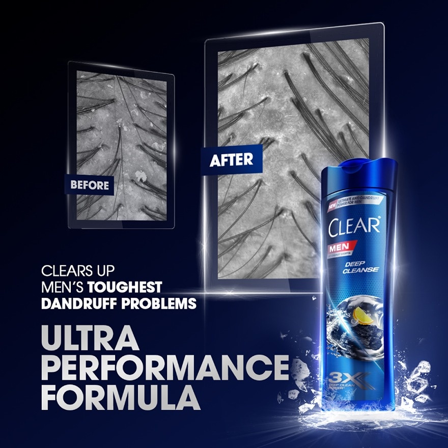 Deep Cleanse Anti Dandruff Shampoo 315ml image