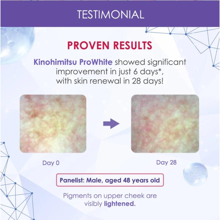 Kinohimitsu Prowhite 8G x 30S image