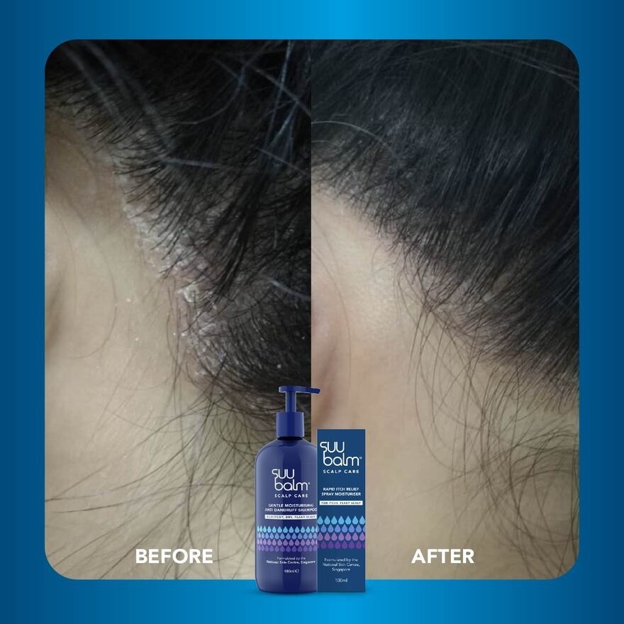 Gentle Moisturising Anti Dandruff Shampoo 480ml