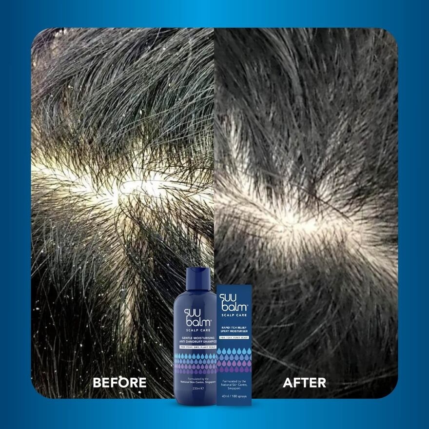 Gentle Moisturising Anti Dandruff Shampoo 480ml