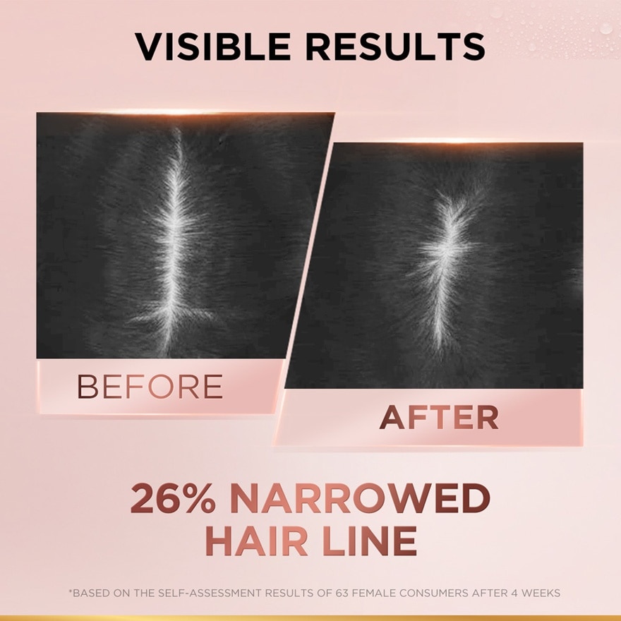 Full Resist Anti Hair Fall Shampoo 440ml