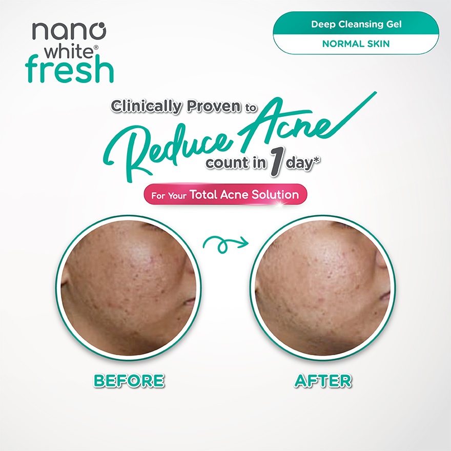 Fresh Deep Cleansing Gel 100ml image