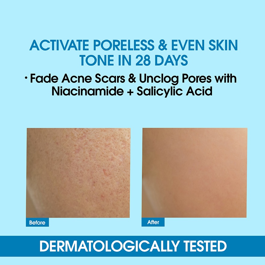 Niacinamide Boosting Serum 30ml image