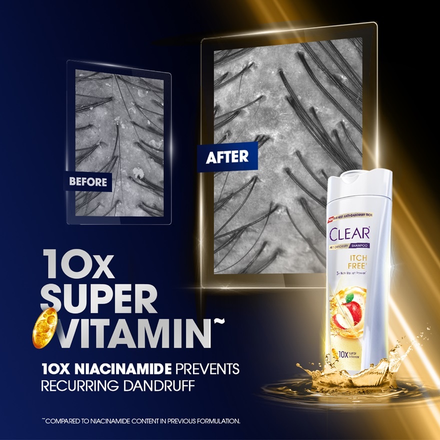 Anti-Dandruff Itch Free Shampoo 300ml image