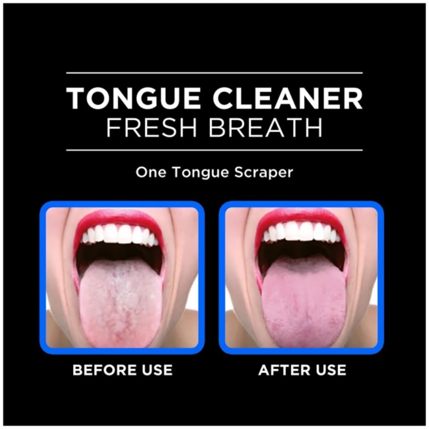 Tongue Cleaner & Scraper 1's image