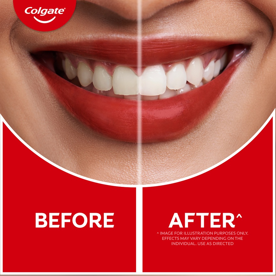 Colgate Optic White Teeth Whitening Wand 2.5ml image