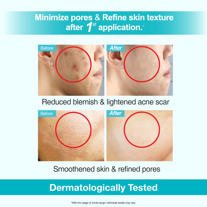 Clinelle Blemish Clear 15ml image