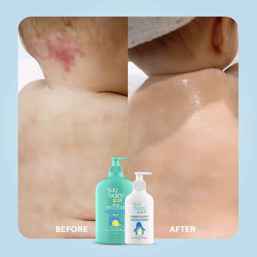 Kids Itch Relieving & Restoring Moisturiser 25ml