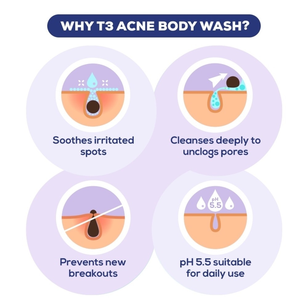 Acne Body Wash - Bactericidal 200ml