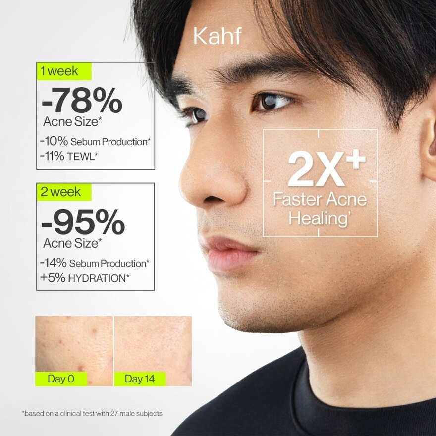 Oil and Acne Care Face Wash 100ml