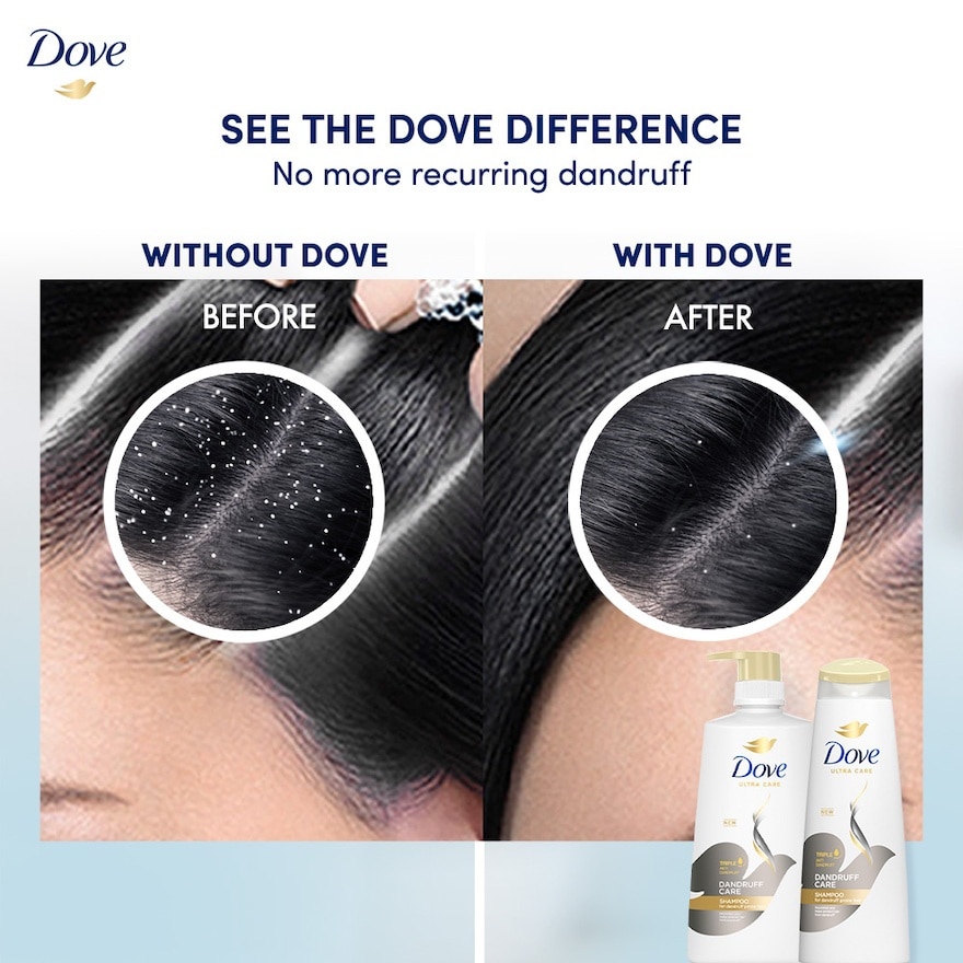 Shampoo Dandruff Care 330ml