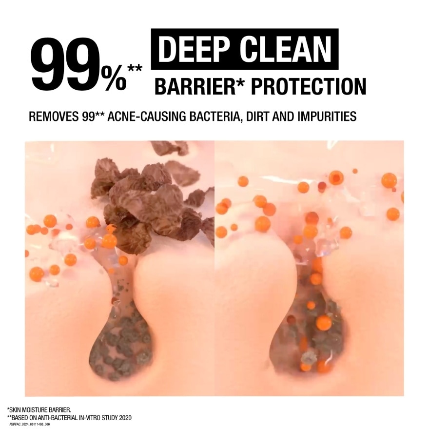 Deep Clean Acne Foam Cleanser 100g