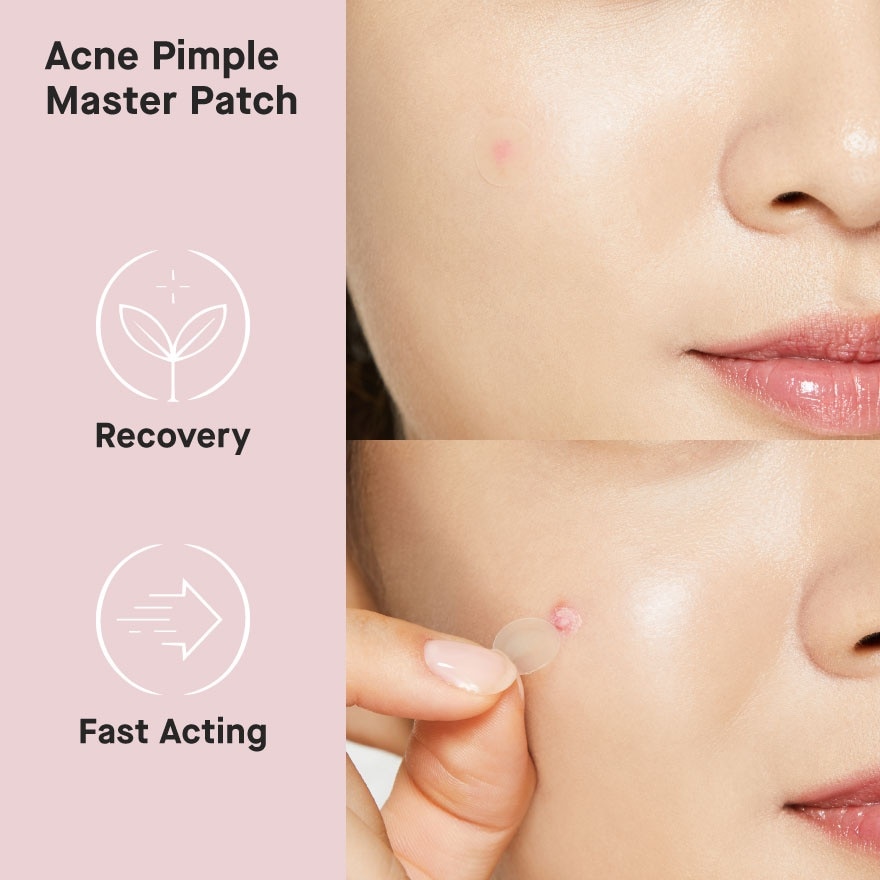 Acne Pimple Master Patch 24S