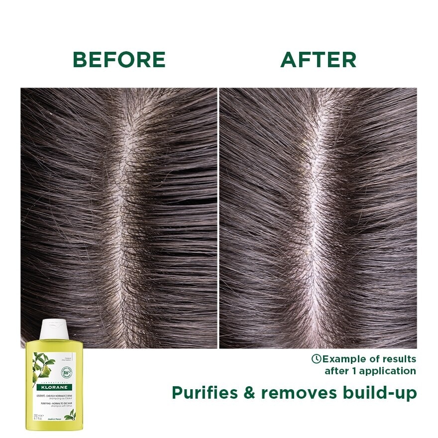 Citrus Pulp Shampoo 400ml (Oily Scalp)