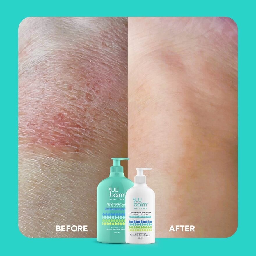 Itch Relieving Moisturising Cream 75ml