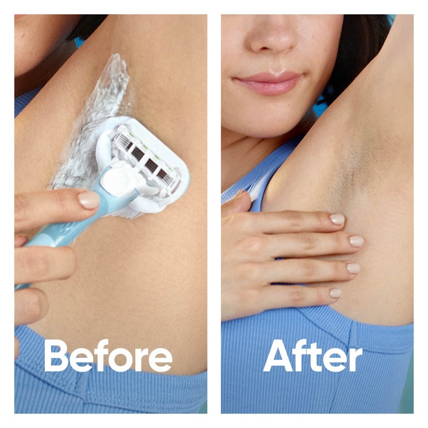 Venus Embrace Cartridge Refill 4s