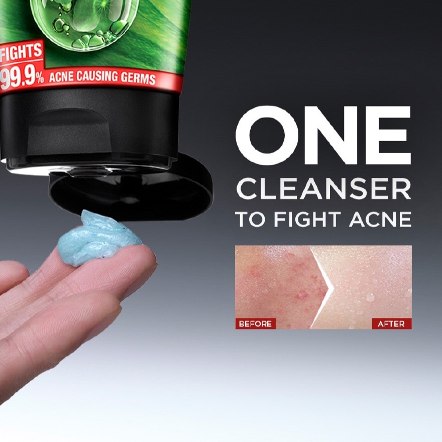 Acno Fight Anti-Acne Foam 50ml