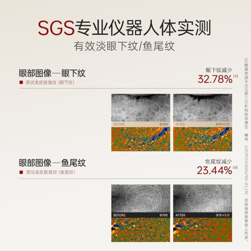 Bifida Ferment Lysate Firming Wrinkle Brightening Eye Cream 5g